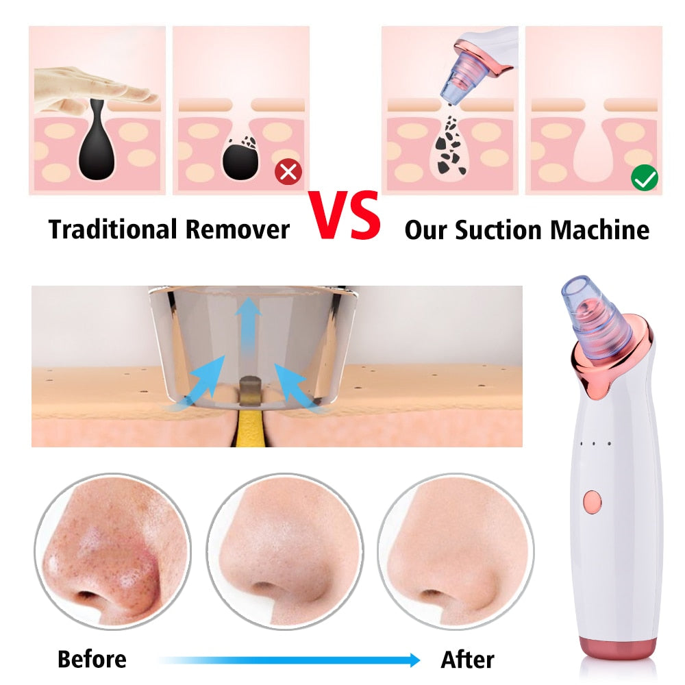 Electric Blackhead Suction & Facial Cleaning Device