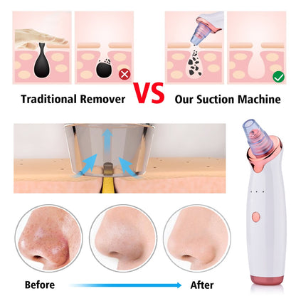 Electric Blackhead Suction & Facial Cleaning Device