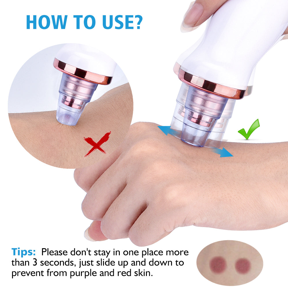 Electric Blackhead Suction & Facial Cleaning Device