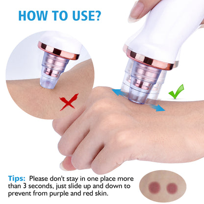 Electric Blackhead Suction & Facial Cleaning Device