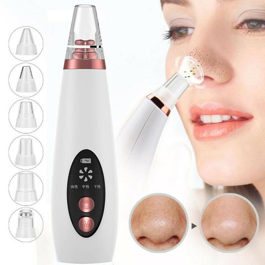 Blackhead Pore Vacuum Cleaner – Facial Suction Beauty Tool